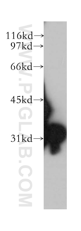 Western Blot (WB) analysis of human lung tissue using SULT1E1 Polyclonal antibody (12522-1-AP)