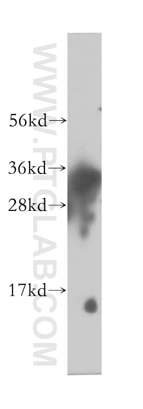 Western Blot (WB) analysis of human liver tissue using SULT1E1 Polyclonal antibody (12522-1-AP)