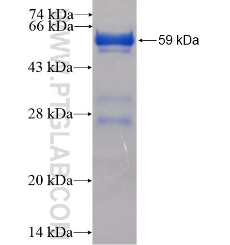SULT1E1 fusion protein Ag3216 SDS-PAGE