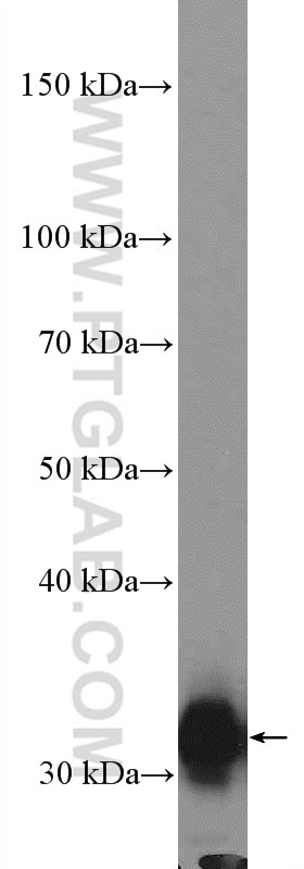 Western Blot (WB) analysis of human liver tissue using SULT2A1 Polyclonal antibody (16348-1-AP)