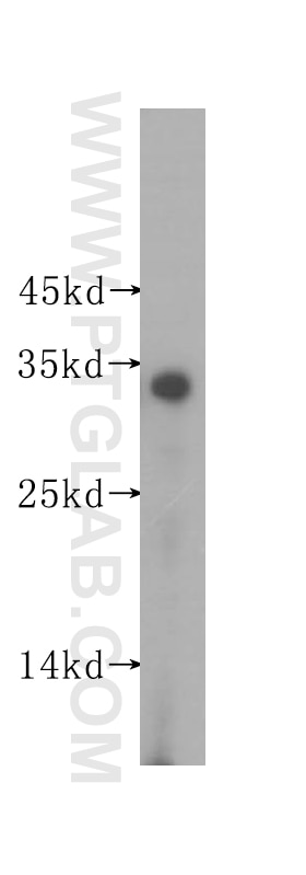 Western Blot (WB) analysis of human adrenal gland tissue using SULT2A1 Polyclonal antibody (16348-1-AP)