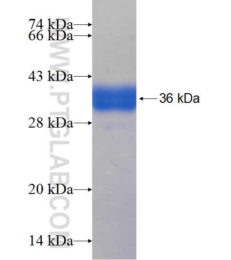 SULT2A1 fusion protein Ag9659 SDS-PAGE