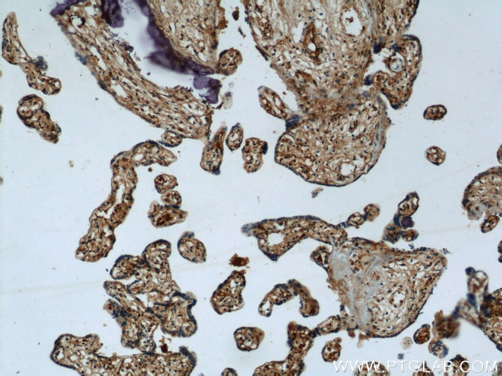 Immunohistochemistry (IHC) staining of human placenta tissue using SULT2B1 Polyclonal antibody (12879-1-AP)