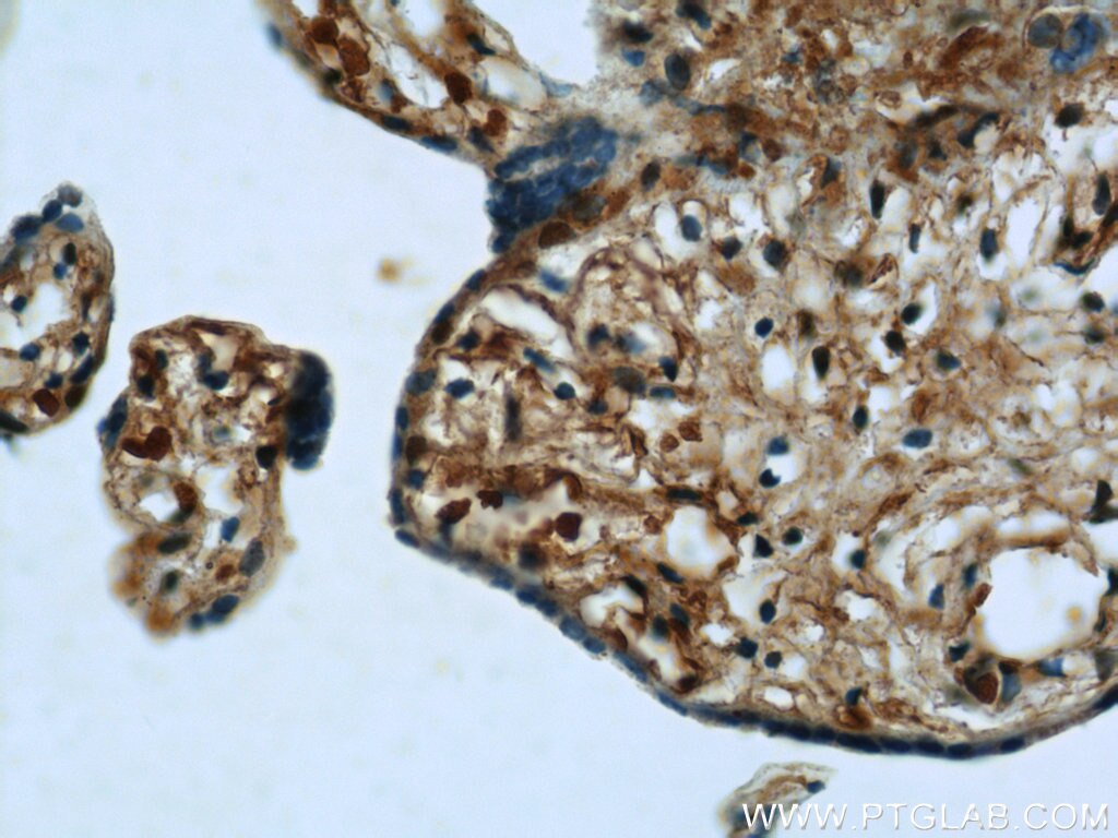 Immunohistochemistry (IHC) staining of human placenta tissue using SULT2B1 Polyclonal antibody (12879-1-AP)