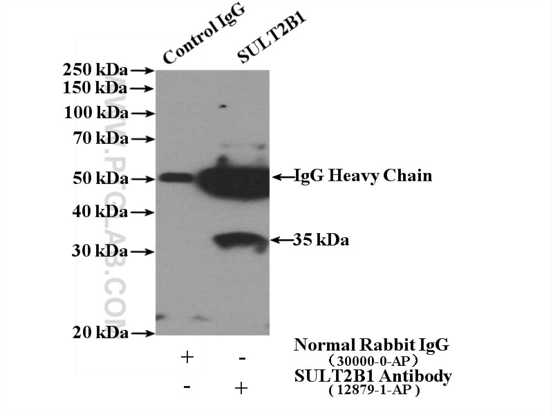 Immunoprecipitation (IP) experiment of mouse skin tissue using SULT2B1 Polyclonal antibody (12879-1-AP)