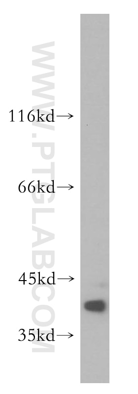 Western Blot (WB) analysis of mouse skin tissue using SULT2B1 Polyclonal antibody (12879-1-AP)