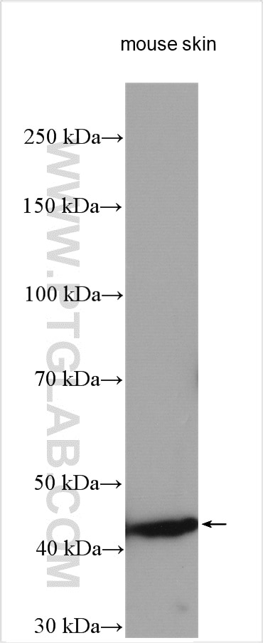 Western Blot (WB) analysis of mouse skin tissue using SULT2B1 Polyclonal antibody (29185-1-AP)