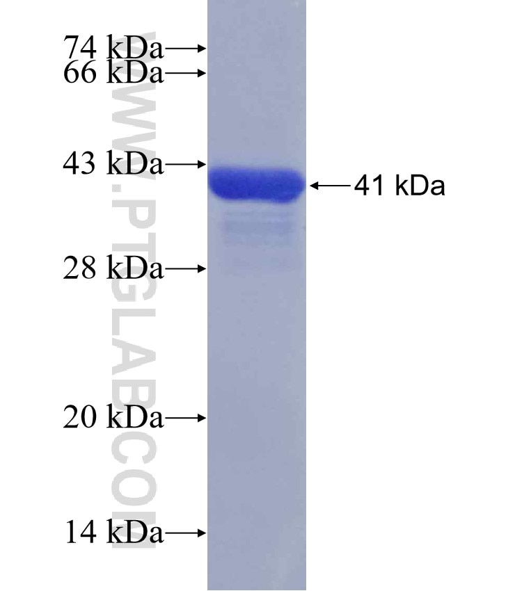 SULT2B1 fusion protein Ag30209 SDS-PAGE