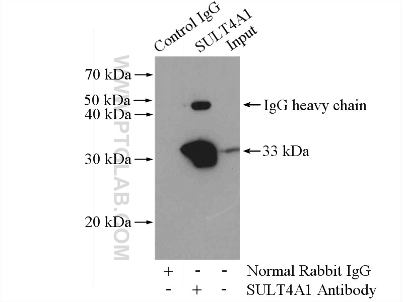 Immunoprecipitation (IP) experiment of mouse brain tissue using SULT4A1 Polyclonal antibody (12578-1-AP)