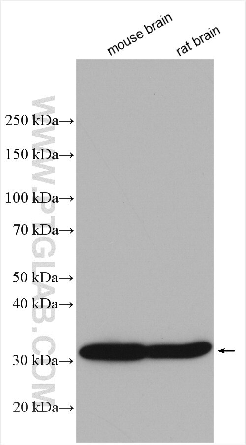 Western Blot (WB) analysis of various lysates using SULT4A1 Polyclonal antibody (12578-1-AP)