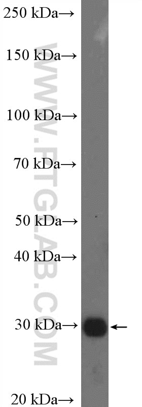 Western Blot (WB) analysis of mouse brain tissue using SULT4A1 Polyclonal antibody (12578-1-AP)