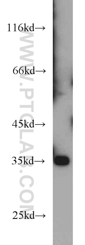 Western Blot (WB) analysis of human brain tissue using SULT4A1 Polyclonal antibody (12578-1-AP)