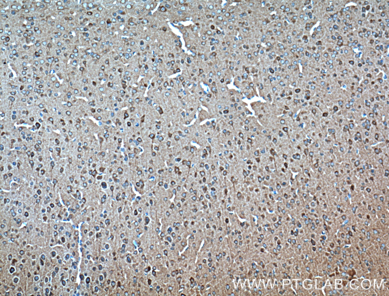 IHC staining of mouse brain using 66106-1-Ig