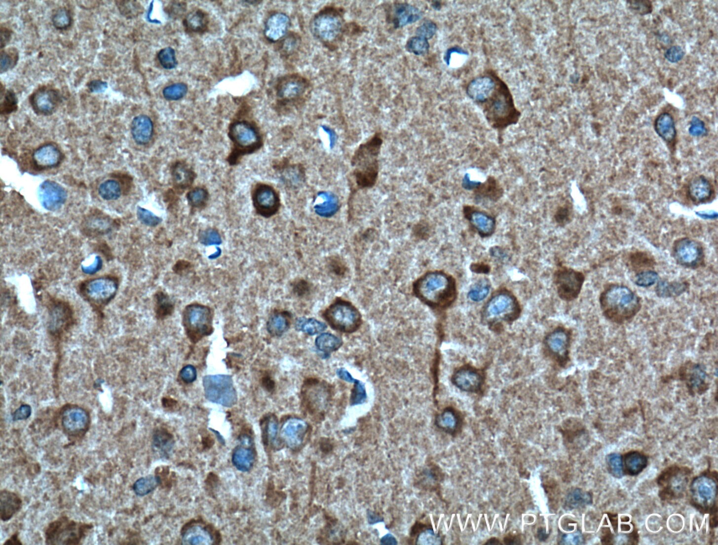 Immunohistochemistry (IHC) staining of mouse brain tissue using SULT4A1 Monoclonal antibody (66106-1-Ig)