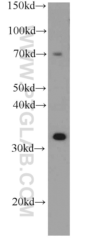 Western Blot (WB) analysis of human brain tissue using SULT4A1 Monoclonal antibody (66106-1-Ig)