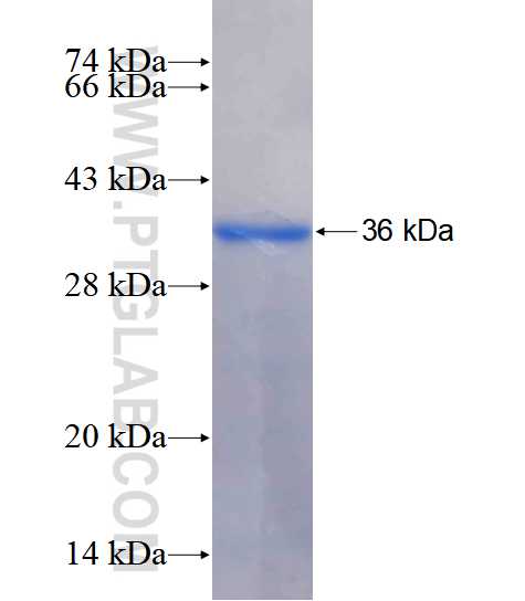 SULT4A1 fusion protein Ag17962 SDS-PAGE