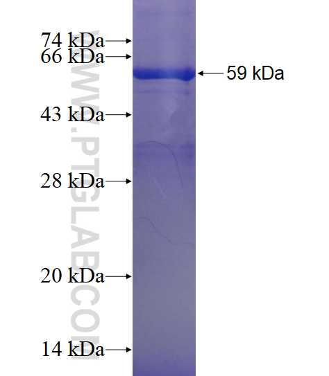 SULT4A1 fusion protein Ag3271 SDS-PAGE