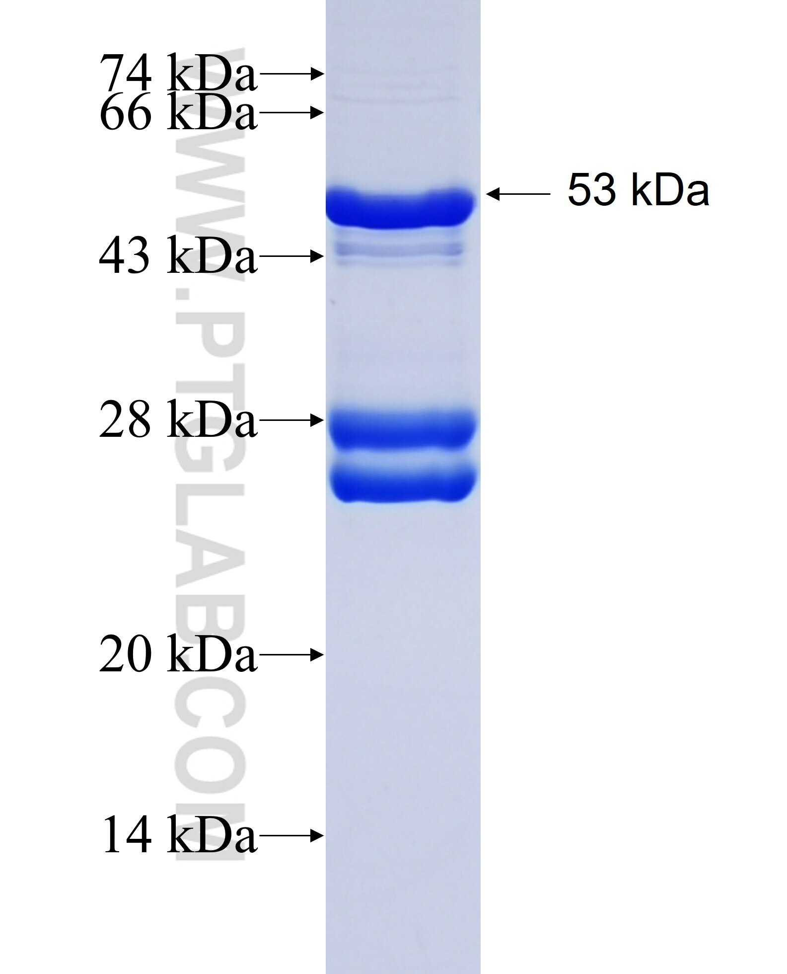 SULT6B1 fusion protein Ag23385 SDS-PAGE
