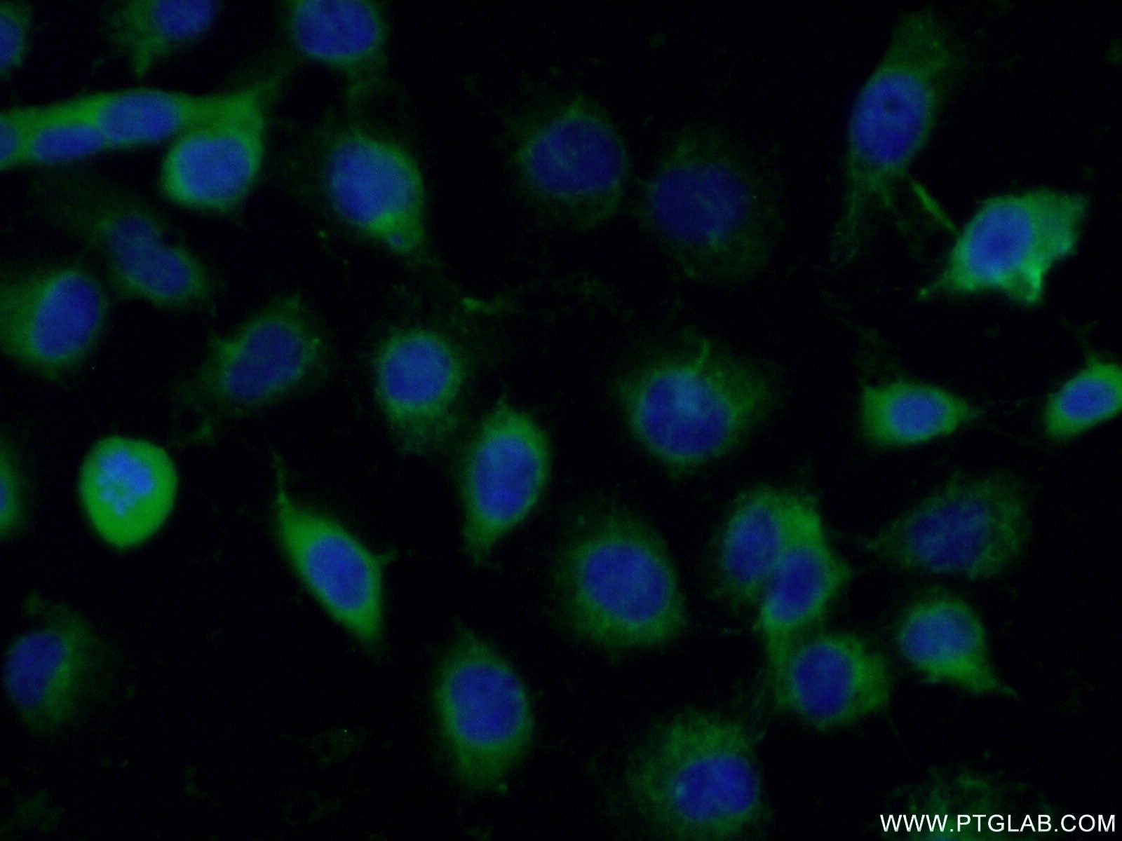 Immunofluorescence (IF) / fluorescent staining of A431 cells using SUMF2 Polyclonal antibody (11210-1-AP)
