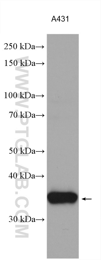 WB analysis using 11210-1-AP