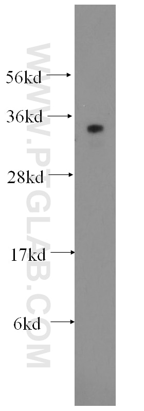 Western Blot (WB) analysis of human spleen tissue using SUMF2 Polyclonal antibody (11210-1-AP)