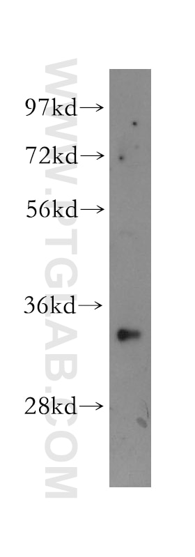 Western Blot (WB) analysis of human skin tissue using SUMF2 Polyclonal antibody (11210-1-AP)