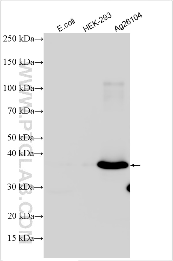 Various lysates were subjected to SDS PAGE followed by western blot with 27205-1-AP (SUMO tag antibody) at dilution of 1:8000 incubated at room temperature for 1.5 hours. Western Blot (WB) analysis of various lysates using SUMO tag Polyclonal antibody (27205-1-AP)