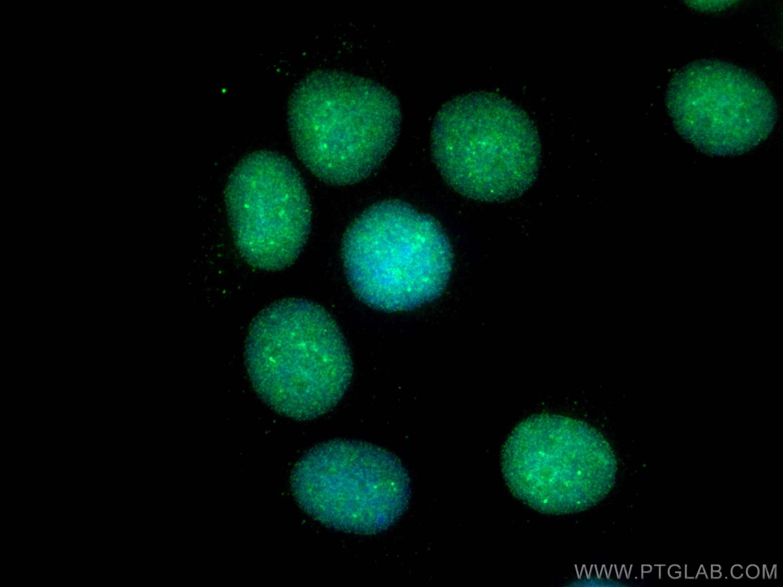 Immunofluorescence (IF) / fluorescent staining of MCF-7 cells using SUMO1 Polyclonal antibody (10329-1-AP)