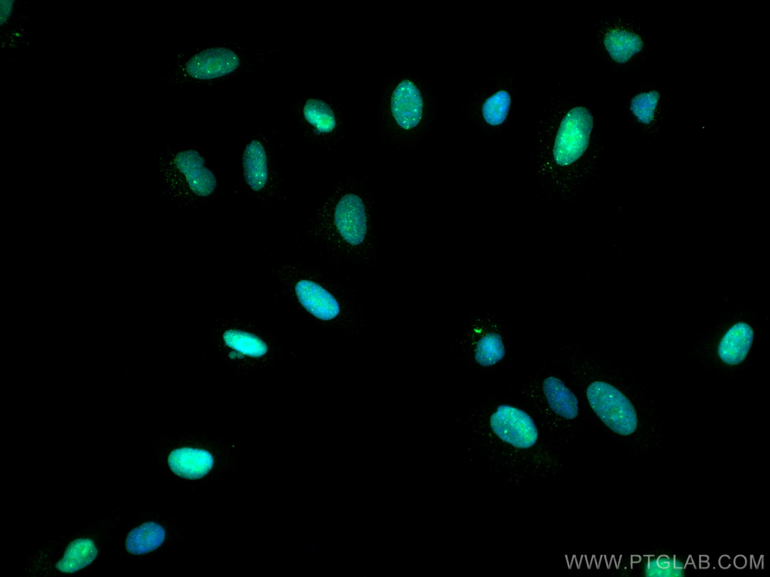 Immunofluorescence (IF) / fluorescent staining of A549 cells using SUMO1 Polyclonal antibody (10329-1-AP)