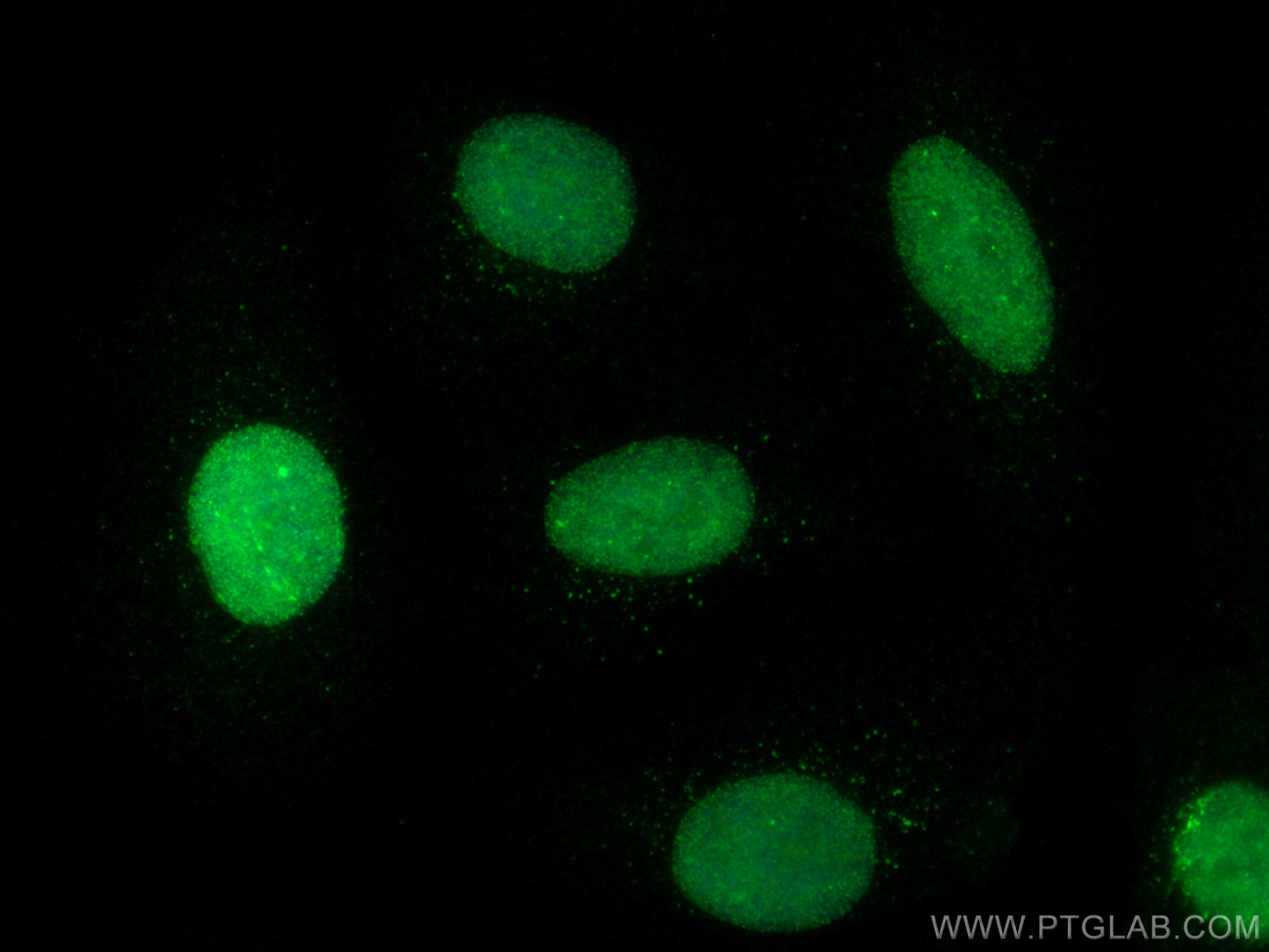Immunofluorescence (IF) / fluorescent staining of A549 cells using SUMO1 Polyclonal antibody (10329-1-AP)