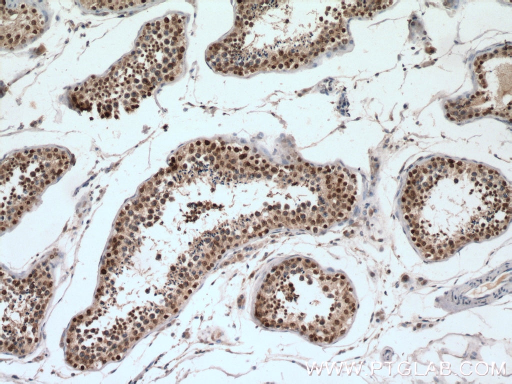 Immunohistochemistry (IHC) staining of human testis tissue using SUMO1 Polyclonal antibody (10329-1-AP)