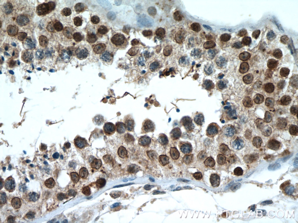 Immunohistochemistry (IHC) staining of human testis tissue using SUMO1 Polyclonal antibody (10329-1-AP)