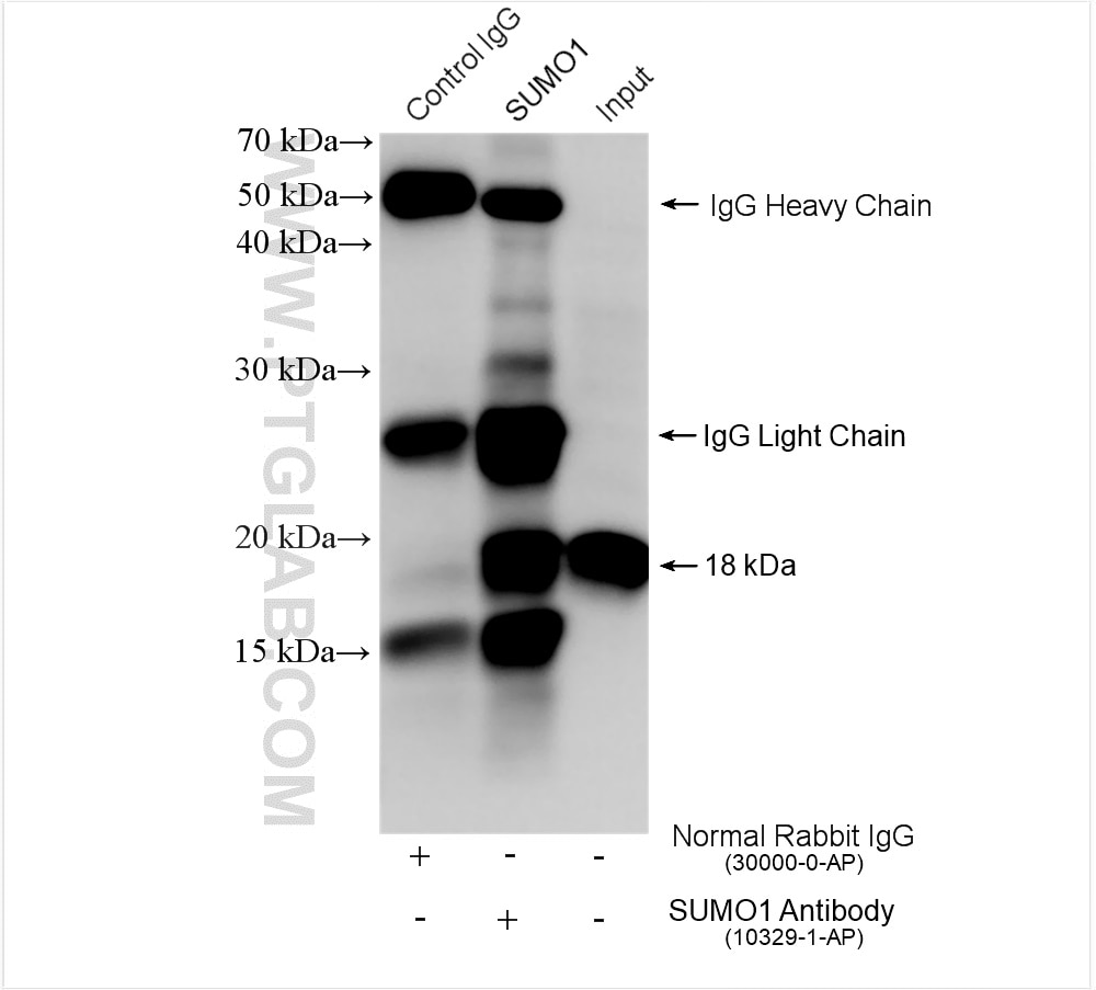 Immunoprecipitation (IP) experiment of HeLa cells using SUMO1 Polyclonal antibody (10329-1-AP)