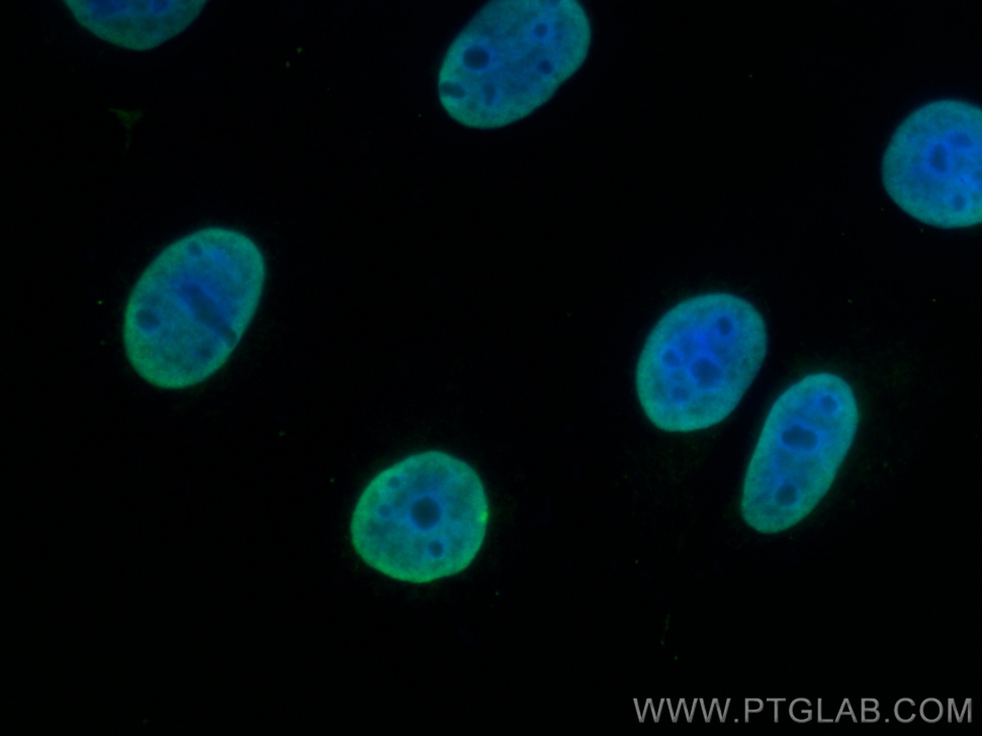 Immunofluorescence (IF) / fluorescent staining of MCF-7 cells using SUMO1 Monoclonal antibody (67559-1-Ig)