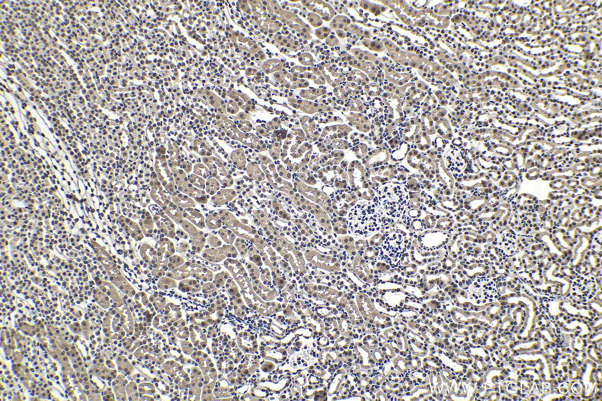 Immunohistochemistry (IHC) staining of mouse kidney tissue using SUMO1 Monoclonal antibody (67559-1-Ig)