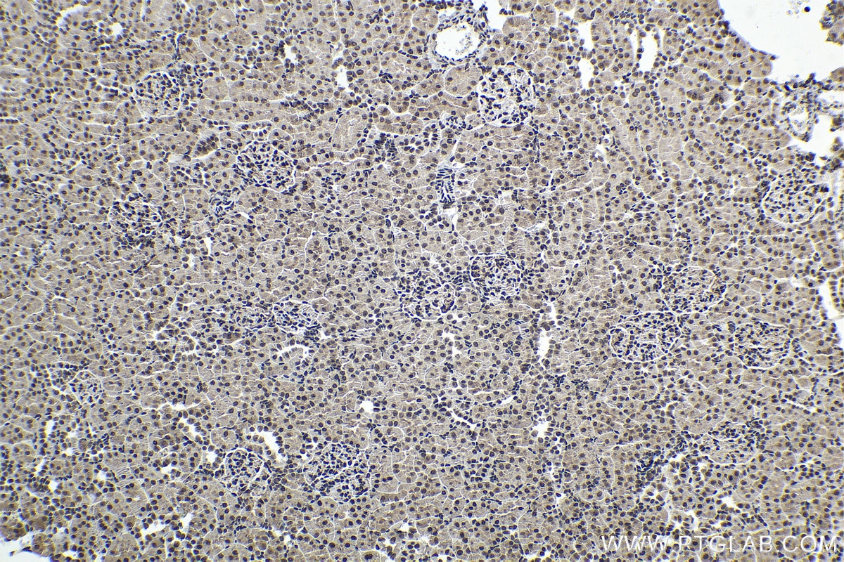 Immunohistochemistry (IHC) staining of rat kidney tissue using SUMO1 Monoclonal antibody (67559-1-Ig)