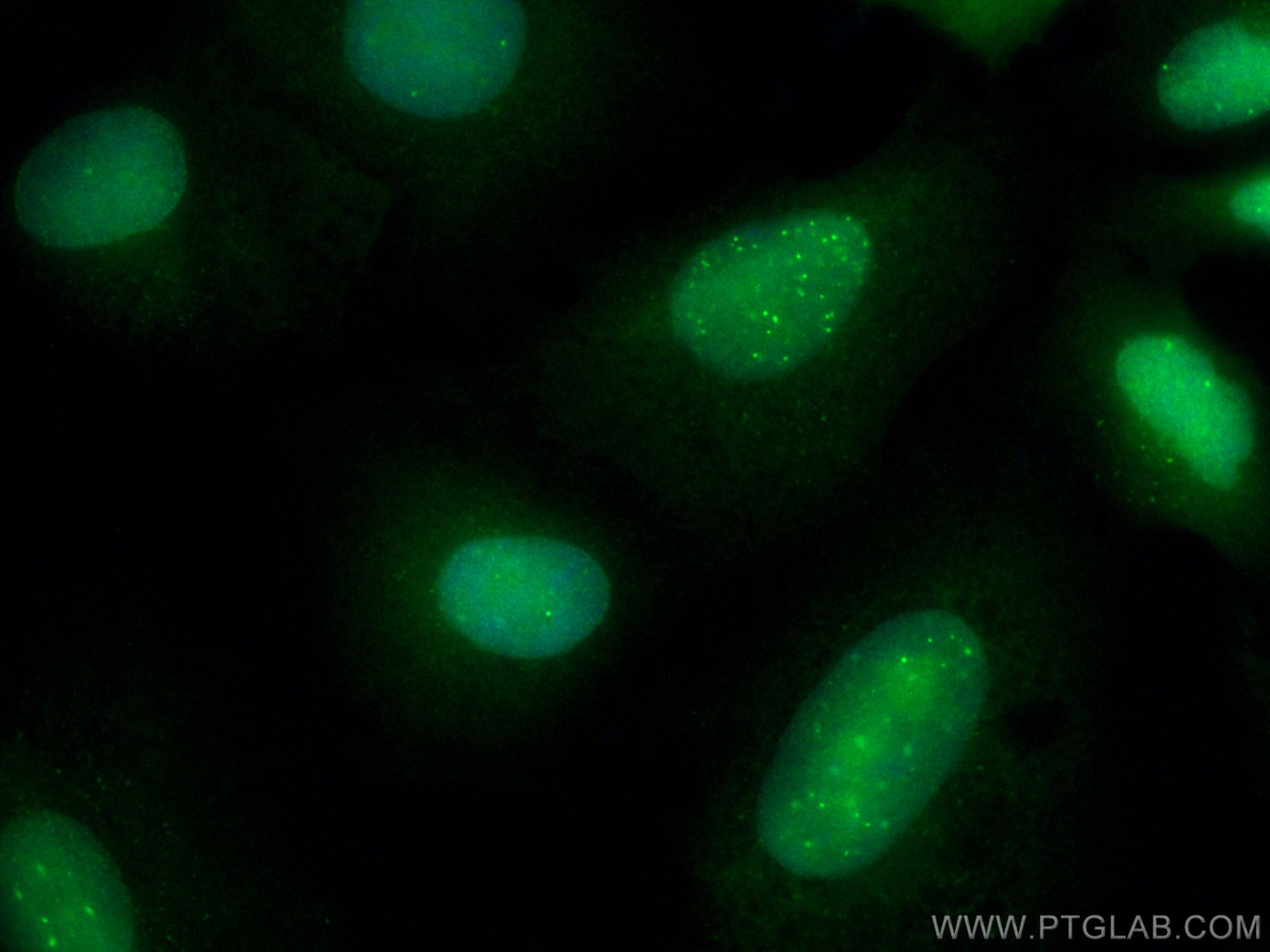 Immunofluorescence (IF) / fluorescent staining of A549 cells using CoraLite® Plus 488-conjugated SUMO1 Polyclonal ant (CL488-10329)