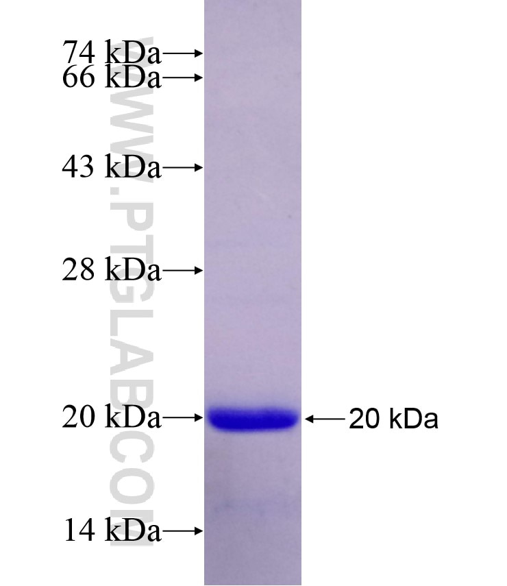 SUMO1 fusion protein Ag29402 SDS-PAGE