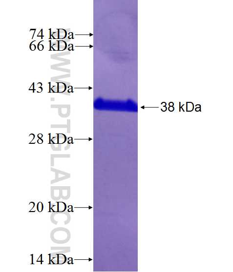 SUMO1 fusion protein Ag0414 SDS-PAGE