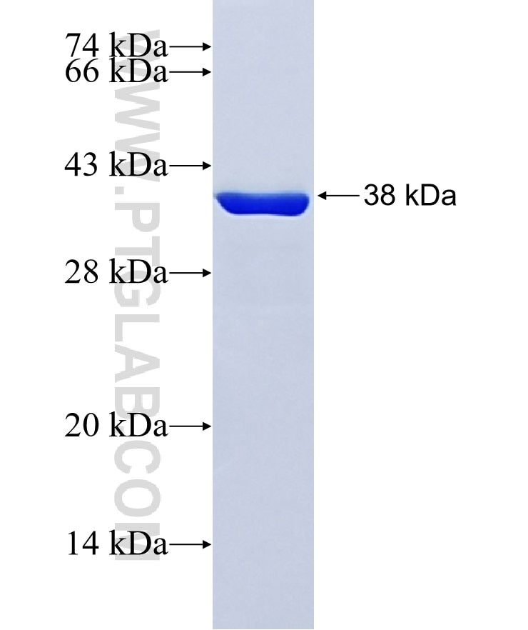 SUMO1 fusion protein Ag0414 SDS-PAGE