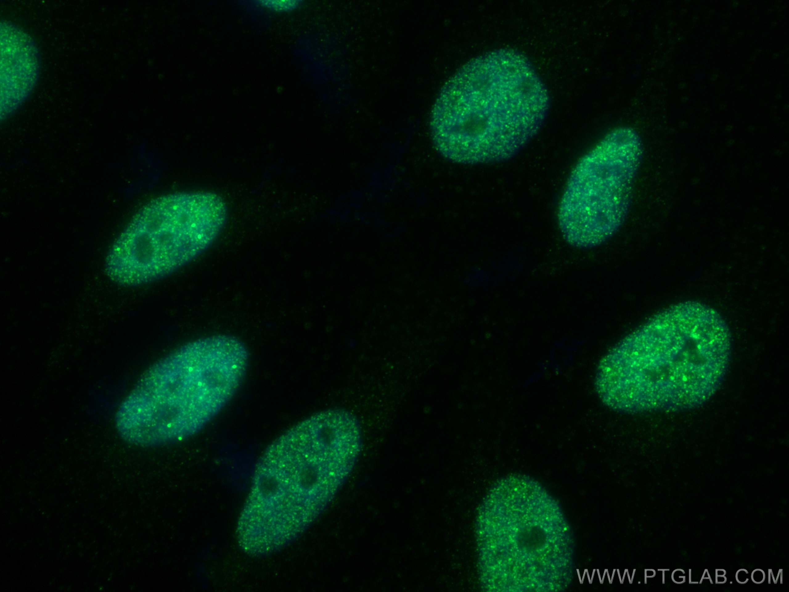 Immunofluorescence (IF) / fluorescent staining of HeLa cells using SUMO2/3 Monoclonal antibody (67154-1-Ig)