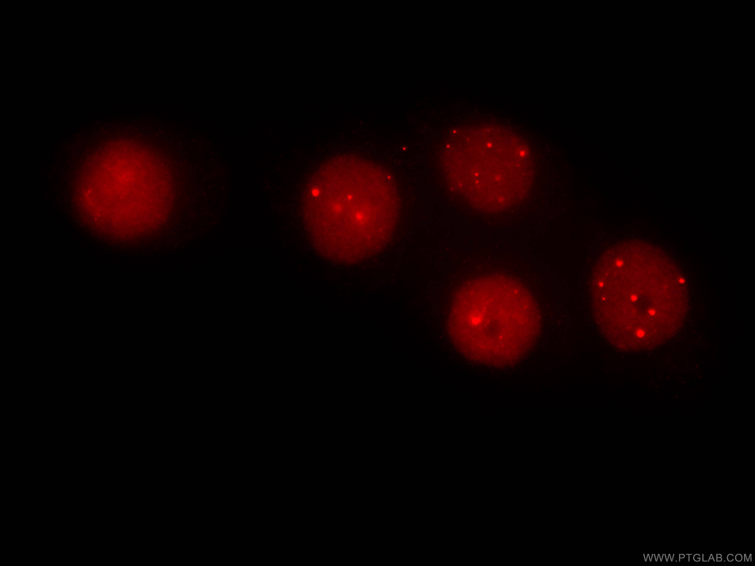 Immunofluorescence (IF) / fluorescent staining of HeLa cells using CoraLite®594-conjugated SUMO2/3 Monoclonal antibod (CL594-67154)