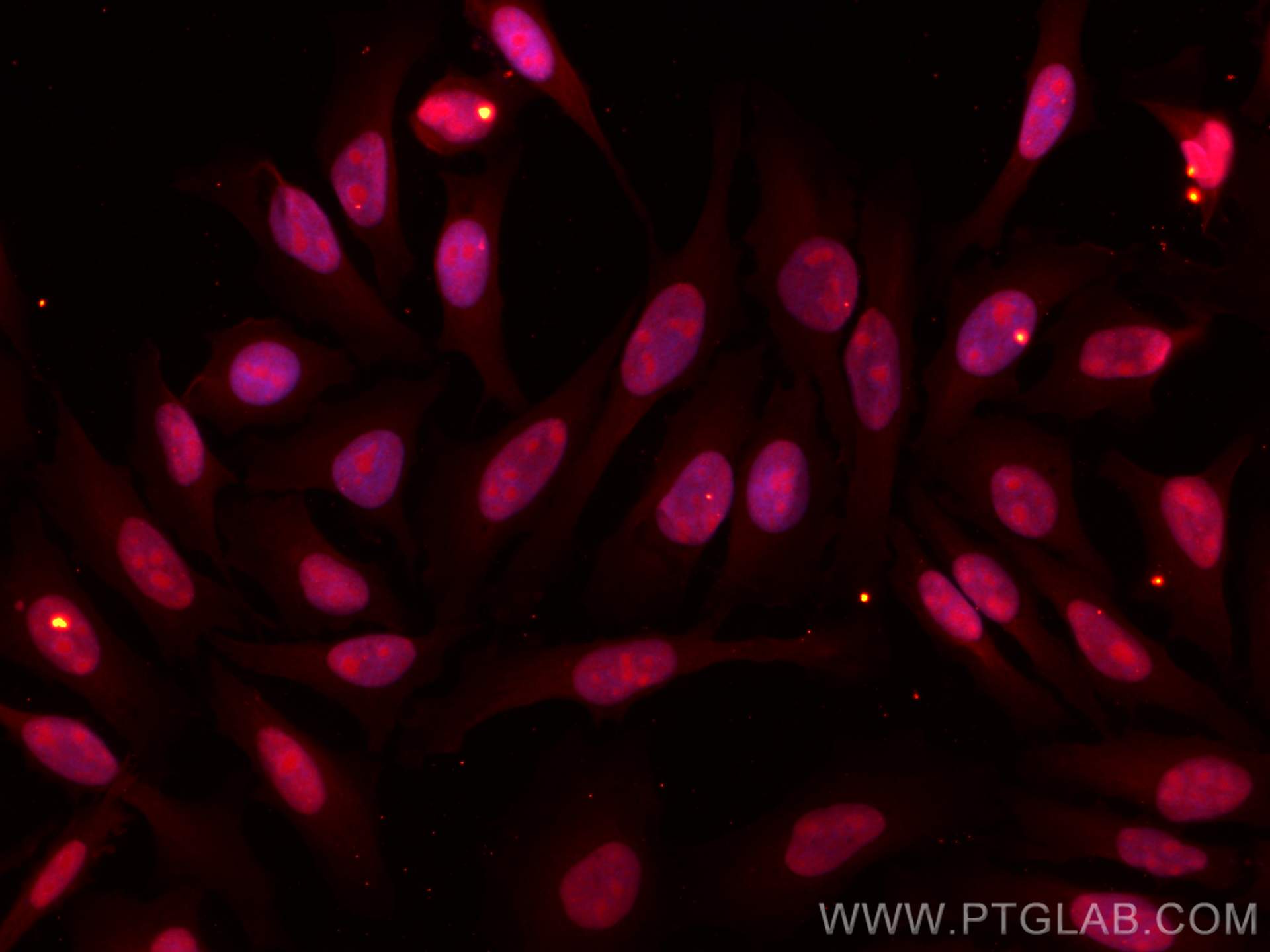 Immunofluorescence (IF) / fluorescent staining of HeLa cells using CoraLite®594-conjugated SUMO2/3 Monoclonal antibod (CL594-67154)