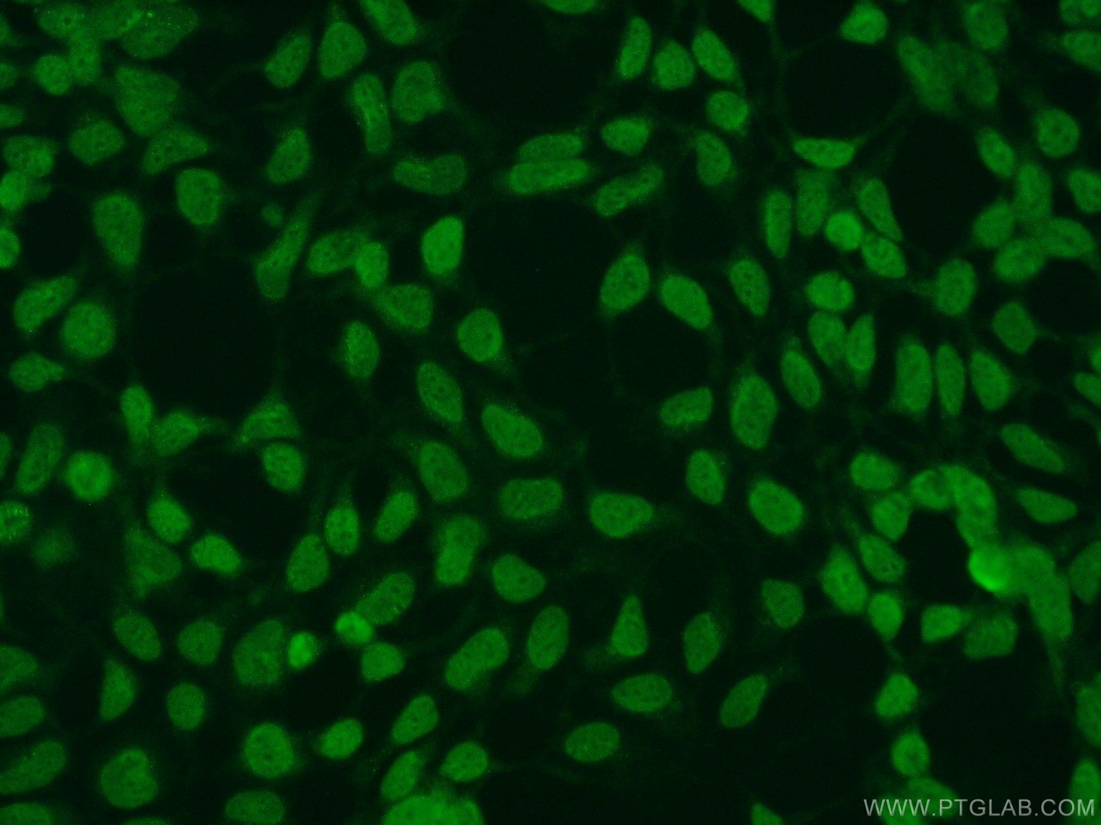 Immunofluorescence (IF) / fluorescent staining of HEK-293 cells using SUMO2/3 Polyclonal antibody (10947-1-AP)