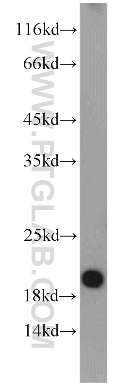 Western Blot (WB) analysis of HEK-293 cells using SUMO2/3 Polyclonal antibody (10947-1-AP)