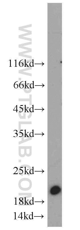 Western Blot (WB) analysis of Jurkat cells using SUMO2/3 Polyclonal antibody (10947-1-AP)