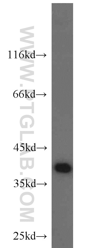 Western Blot (WB) analysis of Recombinant protein using SUMO2/3 Polyclonal antibody (10947-1-AP)