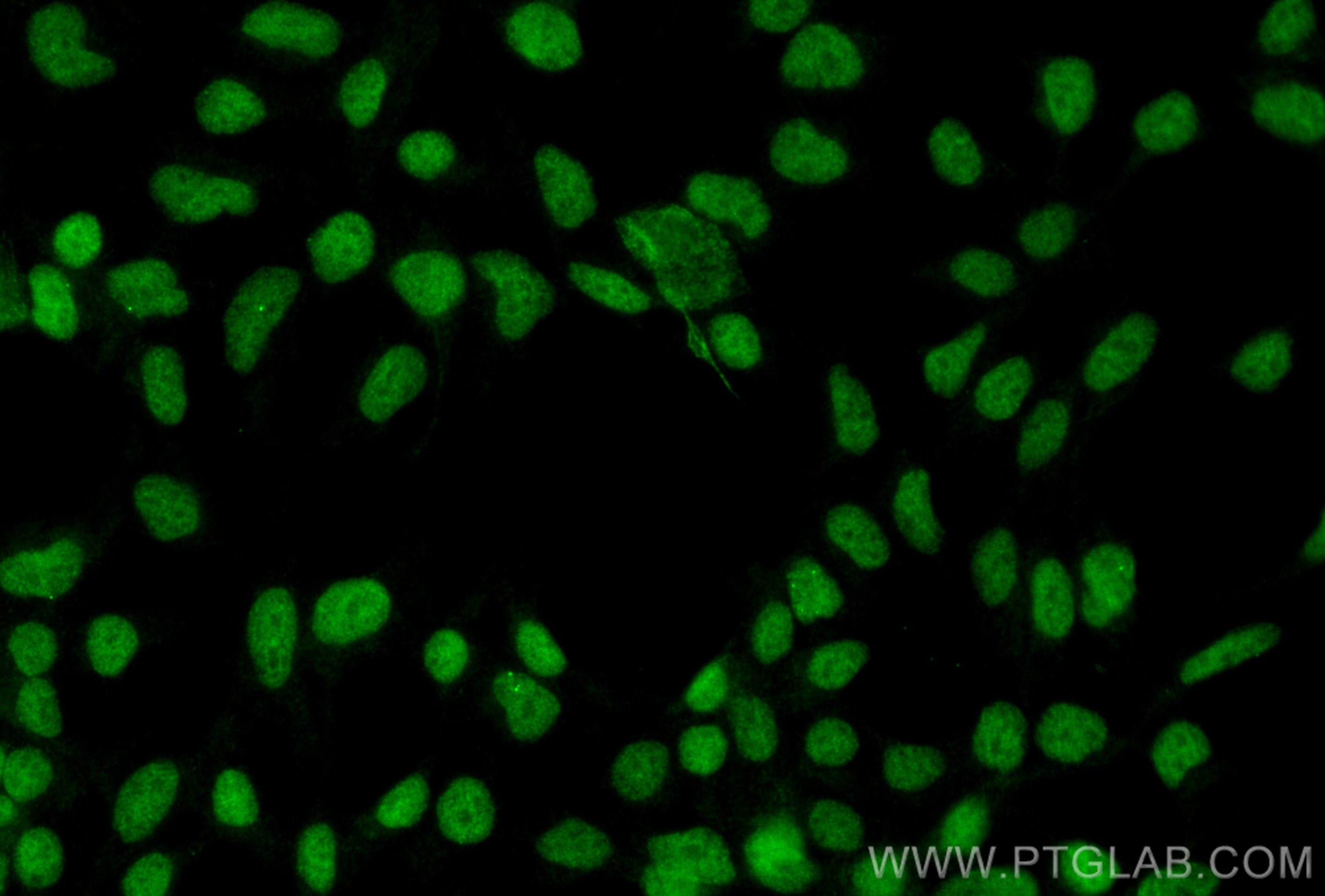 IF Staining of HEK-293 using 11251-1-AP