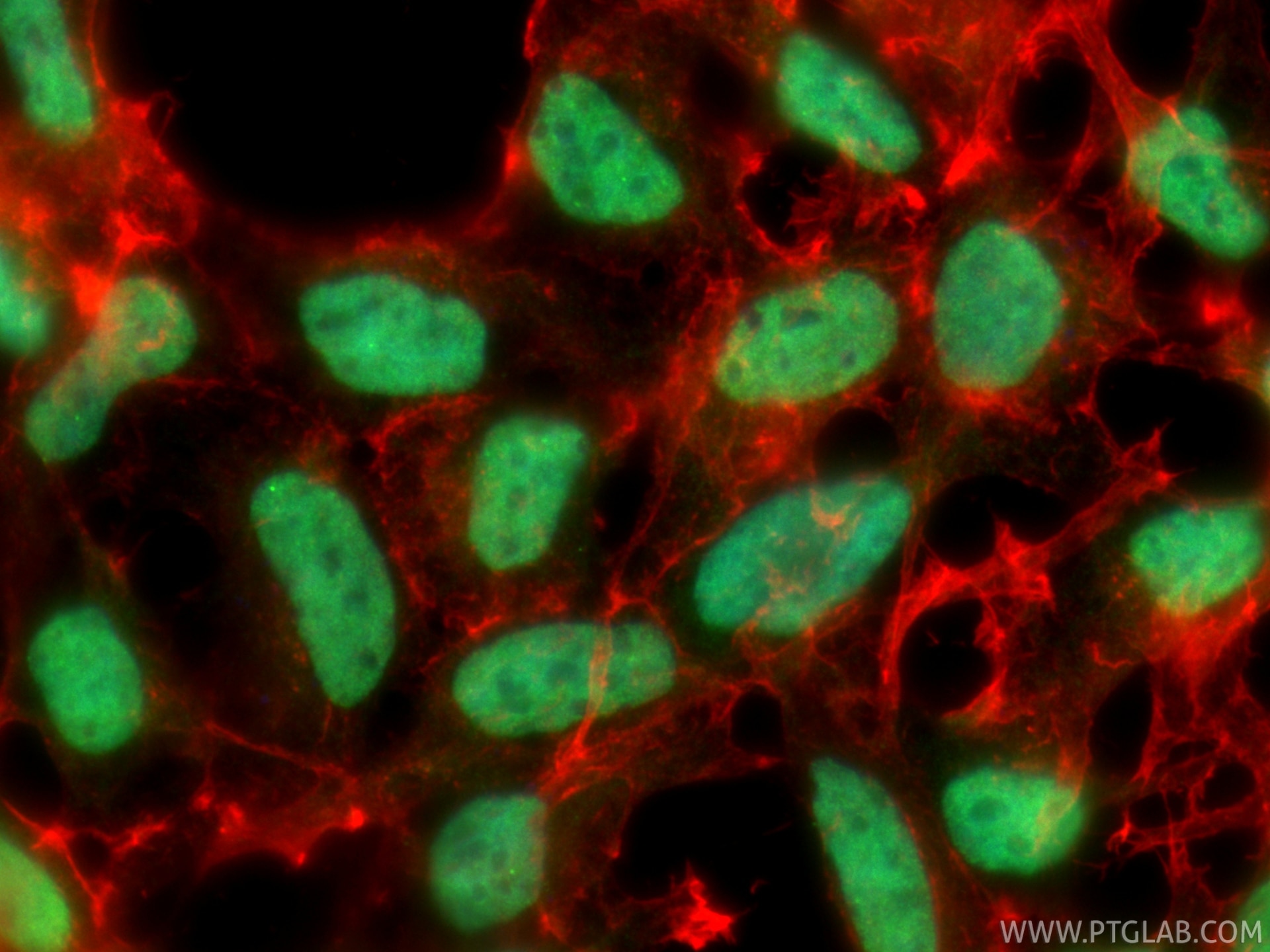 Immunofluorescence (IF) / fluorescent staining of HEK-293 cells using SUMO2/3 Polyclonal antibody (11251-1-AP)