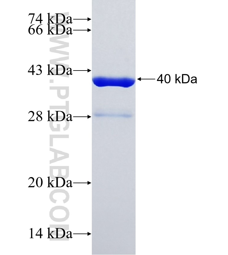 SUMO3 fusion protein Ag1135 SDS-PAGE
